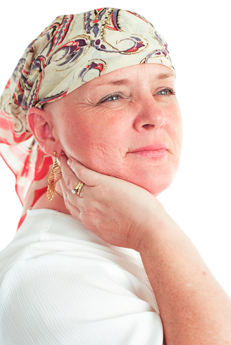 Afbeelding van vrouw met haaruitval door chemotherapie